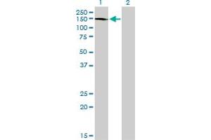 Western Blotting (WB) image for anti-ABL2 (ABL2) (AA 743-842) antibody (ABIN559735)
