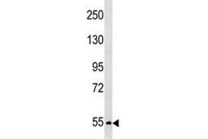 Western Blotting (WB) image for anti-Proprotein Convertase Subtilisin/kexin Type 4 (PCSK4) (AA 168-196) antibody (ABIN3032334)