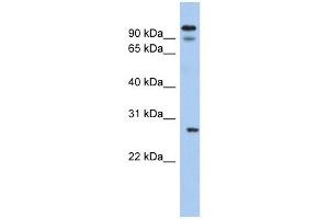 Western Blotting (WB) image for anti-Voltage-Dependent Anion Channel 3 (VDAC3) (N-Term) antibody (ABIN633623)