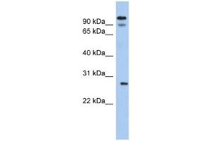 VDAC3 antibody used at 1 ug/ml to detect target protein. (VDAC3 抗体  (N-Term))