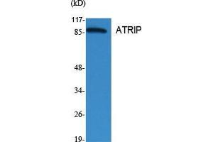 Western Blot (WB) analysis of specific cells using ATRIP Polyclonal Antibody. (ATRIP 抗体  (Tyr783))