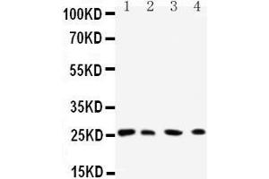Western Blotting (WB) image for anti-RAB3C, Member RAS Oncogene Family (Rab3c) (AA 204-217), (C-Term) antibody (ABIN3042555) (Rab3c 抗体  (C-Term))
