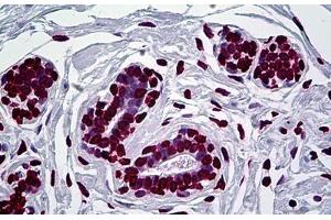 Human Breast: Formalin-Fixed, Paraffin-Embedded (FFPE) (EN1 抗体  (AA 266-392))
