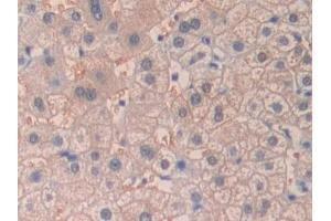 Detection of DHH in Human Liver Tissue using Polyclonal Antibody to Hedgehog Homolog, Desert (DHH) (desert Hedgehog 抗体  (AA 241-383))