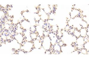 Detection of GAS6 in Mouse Lung Tissue using Polyclonal Antibody to Growth Arrest Specific Protein 6 (GAS6) (GAS6 抗体  (AA 483-646))