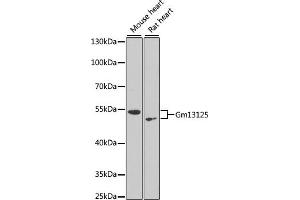 Western blot analysis of extracts of various cell lines, using Gm13125 antibody (ABIN6127294, ABIN6141172, ABIN6141175 and ABIN6216319) at 1:1000 dilution. (Pramel15 抗体  (AA 1-477))