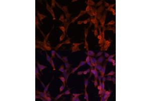Immunofluorescence analysis of NIH-3T3 cells using UBE2G2 antibody (ABIN6130769, ABIN6149798, ABIN6149799 and ABIN6214653) at dilution of 1:100. (UBE2G2 抗体  (AA 1-165))