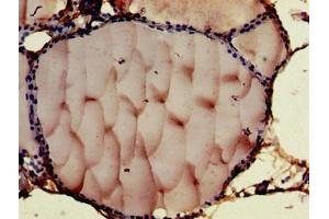 Immunohistochemistry of paraffin-embedded human thyroid tissue using ABIN7148476 at dilution of 1:100 (Contactin 6 抗体  (AA 706-812))