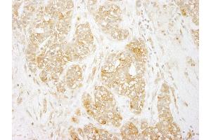 Immunohistochemistry (IHC) image for anti-Nuclear Factor-kB p65 (NFkBP65) (AA 501-551) antibody (ABIN7448771) (NF-kB p65 抗体  (AA 501-551))