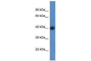 Western Blot showing AGPAT3 antibody used at a concentration of 1 ug/ml against Fetal Liver Lysate (AGPAT3 抗体  (Middle Region))