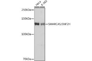 Western blot analysis of extracts of various cell lines, using SM/SM/SNF2H Rabbit mAb (ABIN7270656) at 1:1000 dilution. (SMARCA5 抗体)