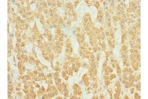Immunohistochemistry of paraffin-embedded human adrenal gland tissue using ABIN7167252 at dilution of 1:100 (RAB23 抗体  (AA 1-237))