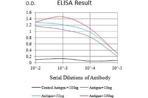 Black line: Control Antigen (100 ng),Purple line: Antigen (10 ng), Blue line: Antigen (50 ng), Red line:Antigen (100 ng)
