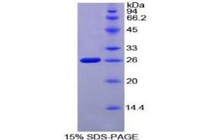 SDS-PAGE analysis of Mouse F8A1 Protein. (Coagulation Factor VIII-Associated 1 (F8A1) 蛋白)