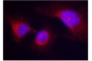 Immunofluorescence (IF) image for anti-Spleen tyrosine Kinase (SYK) (pTyr323) antibody (ABIN1870661) (SYK 抗体  (pTyr323))