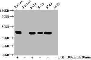 Western Blot Positive WB detected in Jurkat whole cell lysate 72ela whole cell lysate 65549 whole cell lysate(treated with EGF or not) All lanes Phospho-MAPK3 antibody at 0. (Recombinant ERK1 抗体  (pThr183, pThr202, pThr204, pTyr187))