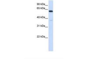 Image no. 1 for anti-Asparagine-Linked Glycosylation 6, alpha-1,3-Glucosyltransferase Homolog (ALG6) (AA 74-123) antibody (ABIN6738286) (ALG6 抗体  (AA 74-123))