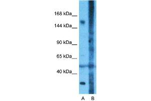 Host:  Rabbit  Target Name:  CNTNAP1  Sample Type:  Fetal Lung  Lane A:  Primary Antibody  Lane B:  Primary Antibody + Blocking Peptide  Primary Antibody Concentration:  1ug/ml  Peptide Concentration:  5ug/ml  Lysate Quantity:  25ug/lane/Lane  Gel Concentration:  0. (CNTNAP1 抗体  (N-Term))