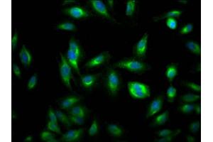 Immunofluorescence staining of Hela Cells with ABIN7127792 at 1:50, counter-stained with DAPI.