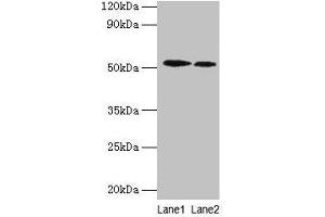 Western blot All lanes: RPS6KB2 antibody at 2 μg/mL Lane 1: EC109 whole cell lysate Lane 2: 293T whole cell lysate Secondary Goat polyclonal to rabbit IgG at 1/15000 dilution Predicted band size: 54, 17 kDa Observed band size: 54 kDa (RPS6KB2 抗体  (AA 1-210))