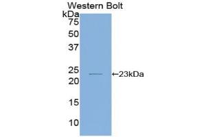Western blot analysis of the recombinant protein. (IL-1 beta 抗体  (AA 63-247))