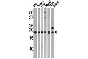 Western blot testing of LC3C antibody. (LC3C 抗体  (AA 1-30))