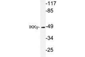 Western blot analysis of IKKγ antibody in extracts from 293 HepG2 cells. (IKBKG 抗体)