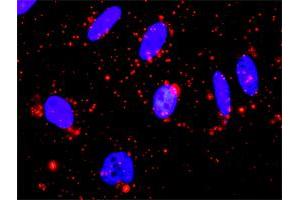 Proximity Ligation Analysis of protein-protein interactions between MAPK13 and MAPKAPK3. (MAPKAP Kinase 3 抗体  (AA 272-382))