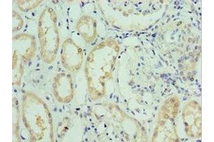 Immunohistochemistry (IHC) image for anti-Solute Carrier Family 39 (Zinc Transporter), Member 6 (SLC39A6) (AA 170-320) antibody (ABIN7176713)