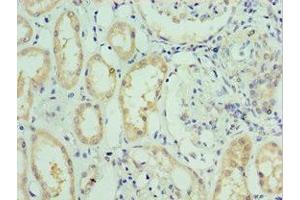 Immunohistochemistry of paraffin-embedded human kidney tissue using ABIN7176713 at dilution of 1:100 (SLC39A6 抗体  (AA 170-320))