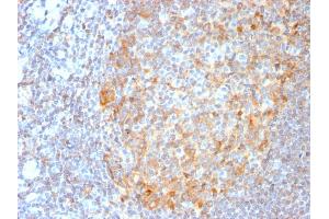 Formalin-fixed, paraffin-embedded human Tonsil stained with MALT1 Recombinant Rabbit Monoclonal Antibody (MT1/3159R). (Recombinant MALT1 抗体  (AA 701-808))