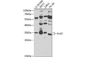 Western blot analysis of extracts of various cell lines, using ALAD antibody (ABIN6129892, ABIN6136750, ABIN6136752 and ABIN6224446) at 1:1000 dilution. (ALAD 抗体  (AA 1-330))