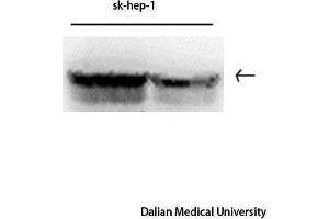 Western Blot (WB) analysis: Please contact us for more details. (Vimentin 抗体)
