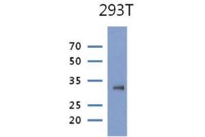 The cell lysate of 293T(30ug) were resolved by SDS-PAGE, transferred to PVDF membrane and probed with anti-human PRPS1 antibody (1:1000). (PRPS1 抗体)