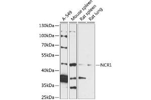 Western blot analysis of extracts of various cell lines, using NCR1 antibody (ABIN7268833) at 1:3000 dilution. (NCR1 抗体  (AA 151-303))