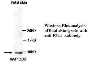 Image no. 1 for anti-Chromosome 5 Open Reading Frame 13 (C5orf13) (C-Term) antibody (ABIN791087) (NREP 抗体  (C-Term))