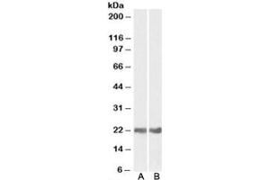 Western blot testing of mouse [A] and rat [B] eye lysates with CRYAB antibody at 0. (CRYAB 抗体)
