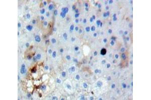 Used in DAB staining on fromalin fixed paraffin-embedded Liver tissue (FUT3 抗体  (AA 30-259))