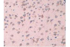 IHC-P analysis of Mouse Brain Tissue, with DAB staining. (TPP1 抗体  (AA 198-562))