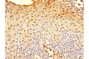 Immunohistochemistry of paraffin-embedded human tonsil tissue using ABIN7173626 at dilution of 1:100 (TSC22D3 抗体  (AA 58-134))