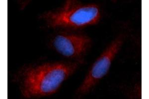 Immunofluorescence (IF) image for anti-Keratin 8 (KRT8) (AA 1-483) antibody (PE) (ABIN5567068) (KRT8 抗体  (AA 1-483) (PE))