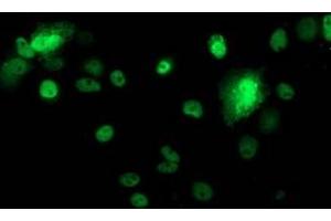 Anti-TP53 mouse monoclonal antibody (ABIN2454484) immunofluorescent staining of COS7 cells transiently transfected by pCMV6-ENTRY TP53 (RC200003). (p53 抗体)