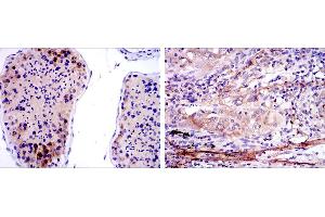 Immunohistochemistry (IHC) image for anti-Survival of Motor Neuron 1, Telomeric (SMN1) antibody (ABIN969407)