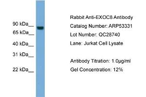 WB Suggested Anti-EXOC8  Antibody Titration: 0. (EXOC8 抗体  (N-Term))