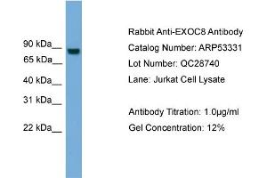 WB Suggested Anti-EXOC8  Antibody Titration: 0.