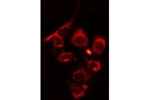 ABIN6275689 staining HT29 cells by IF/ICC. (ZFYVE19 抗体  (Internal Region))