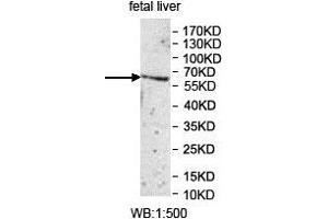 Western blot analysis of fetal liver lysate, using UGT1A1 antibody. (UGT1A1 抗体  (AA 26-193))