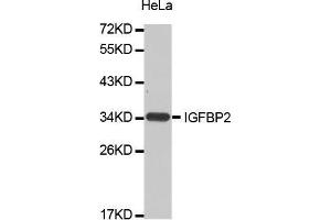Western Blotting (WB) image for anti-Insulin-Like Growth Factor Binding Protein 2, 36kDa (IGFBP2) (AA 100-200) antibody (ABIN5663646) (IGFBP2 抗体  (AA 100-200))