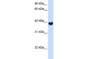 WB Suggested Anti-FOXE1 Antibody Titration: 0. (FOXE1 抗体  (Middle Region))