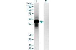 Western Blotting (WB) image for anti-Orthopedia Homeobox (OTP) (AA 11-120) antibody (ABIN1327197)